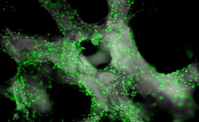 Skeletal stem cells on human bone